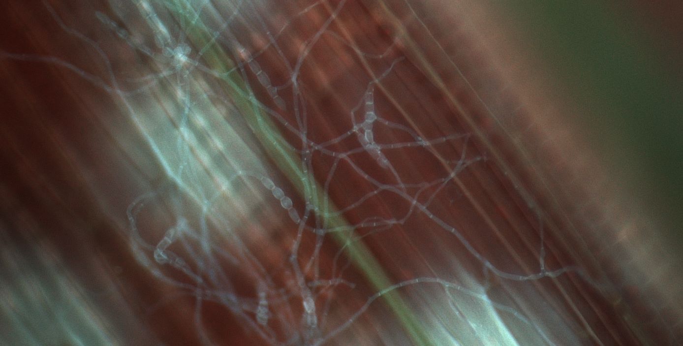 Immagine del micelio al microscopio